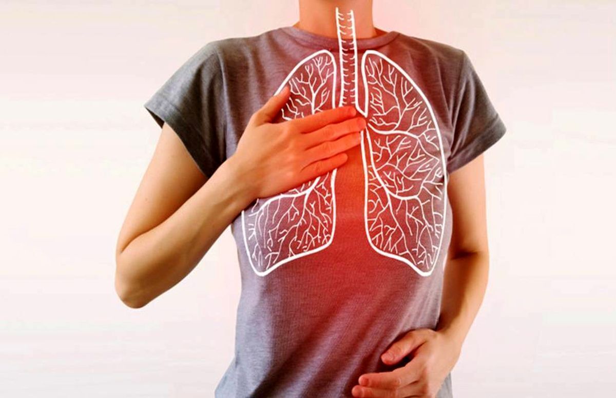 افزایش مبتلایان به سرطان ریه در غیرسیگاری‌ها